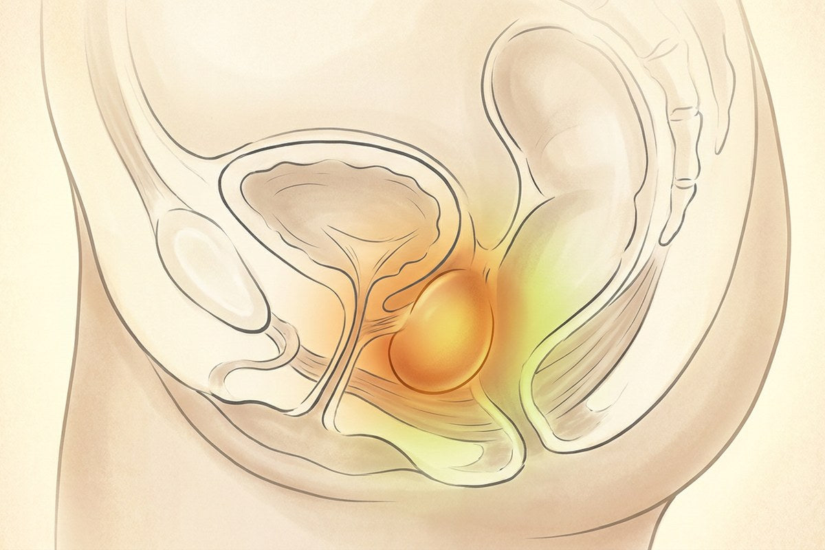 Soft illustration showing estrogen-sensitive tissue concentrated around the bladder, urethra, and trigone